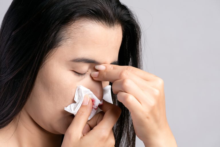 Mulher segura papel no nariz para conter sangramento nasal