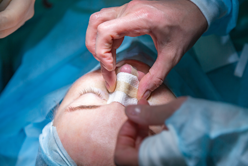 Quando é indicada a rinosseptoplastia?