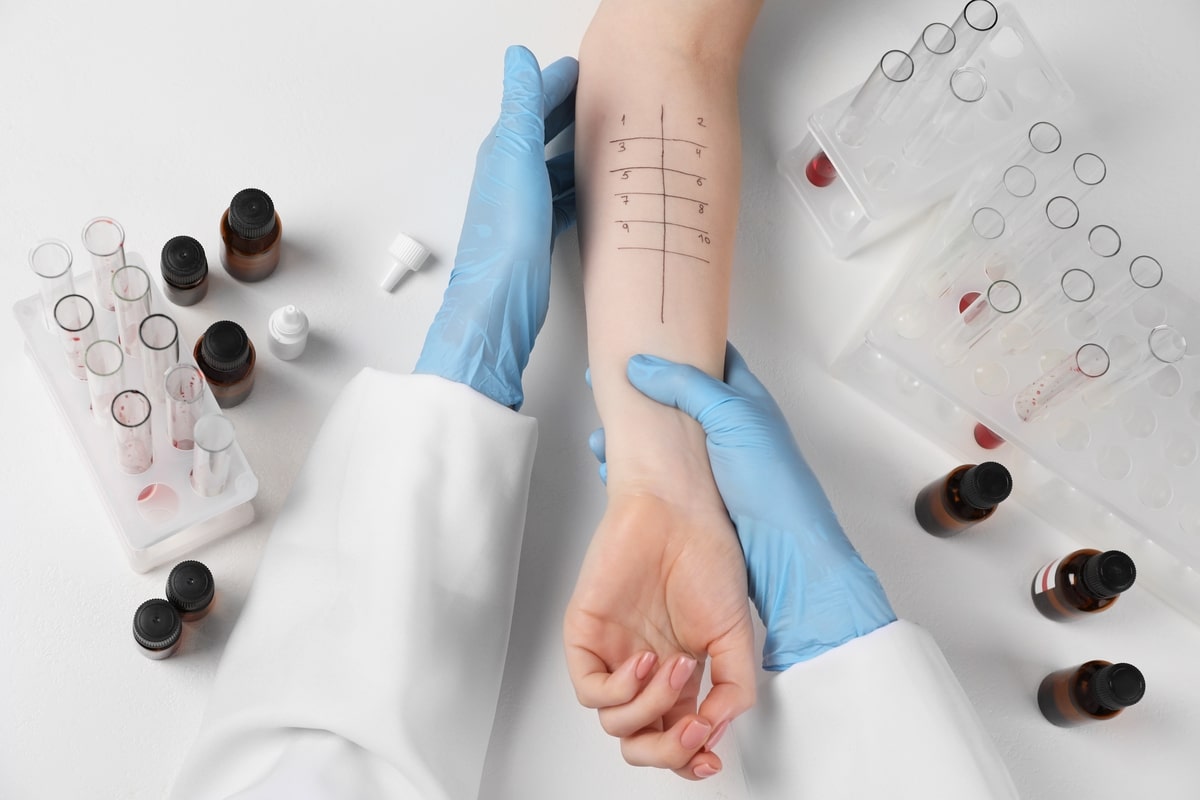 Prick test: saiba tudo sobre o teste cutâneo alérgico