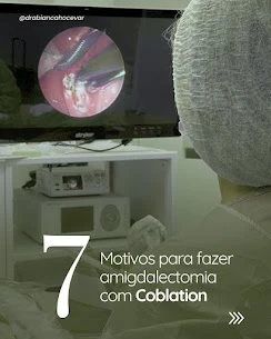 Fazer amigdalectomia com Coblation