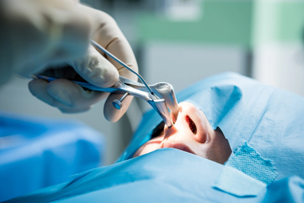 Rinoplastia funcional: entenda a cirurgia que prioriza a saúde
