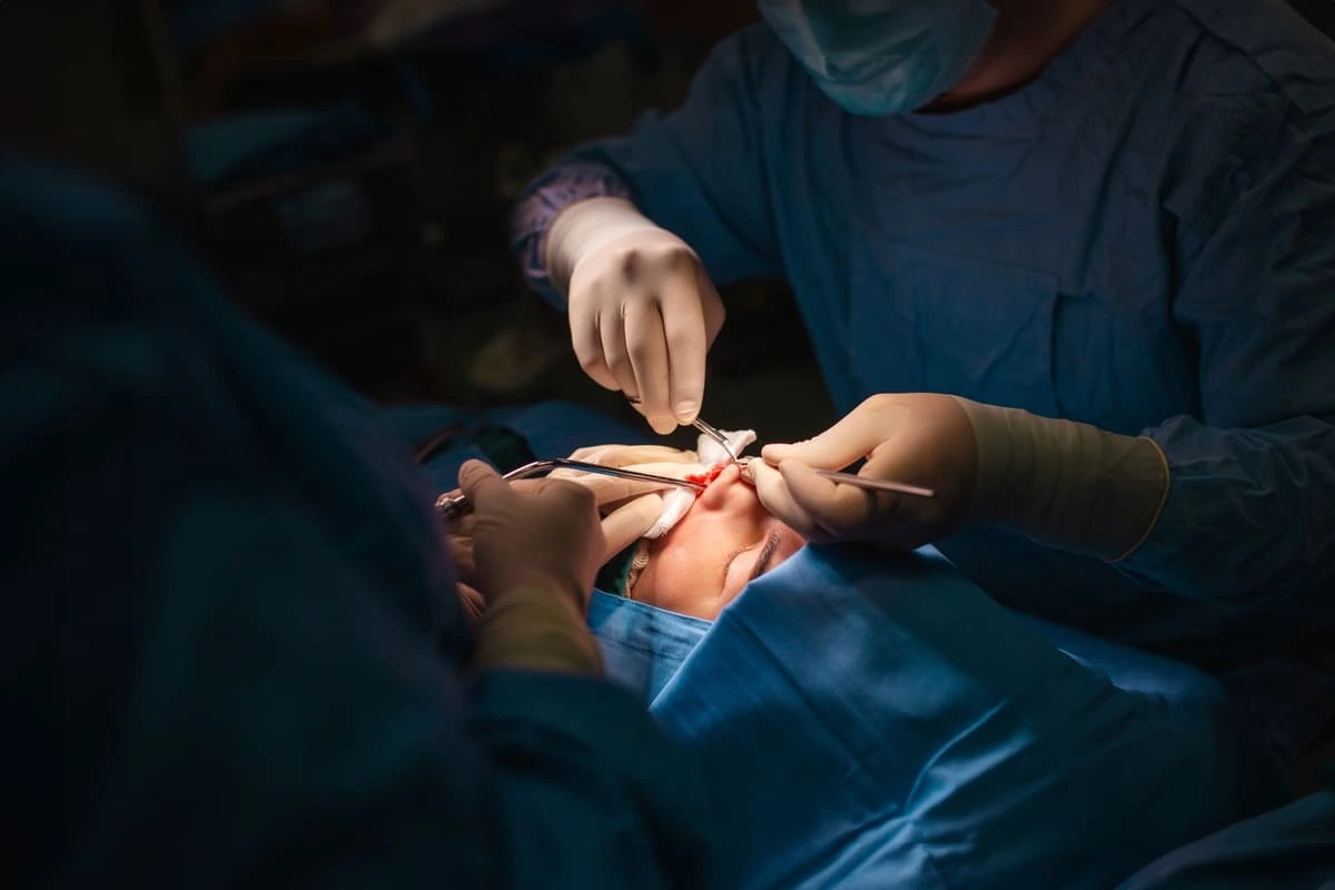 Cirurgia no nariz para respirar melhor